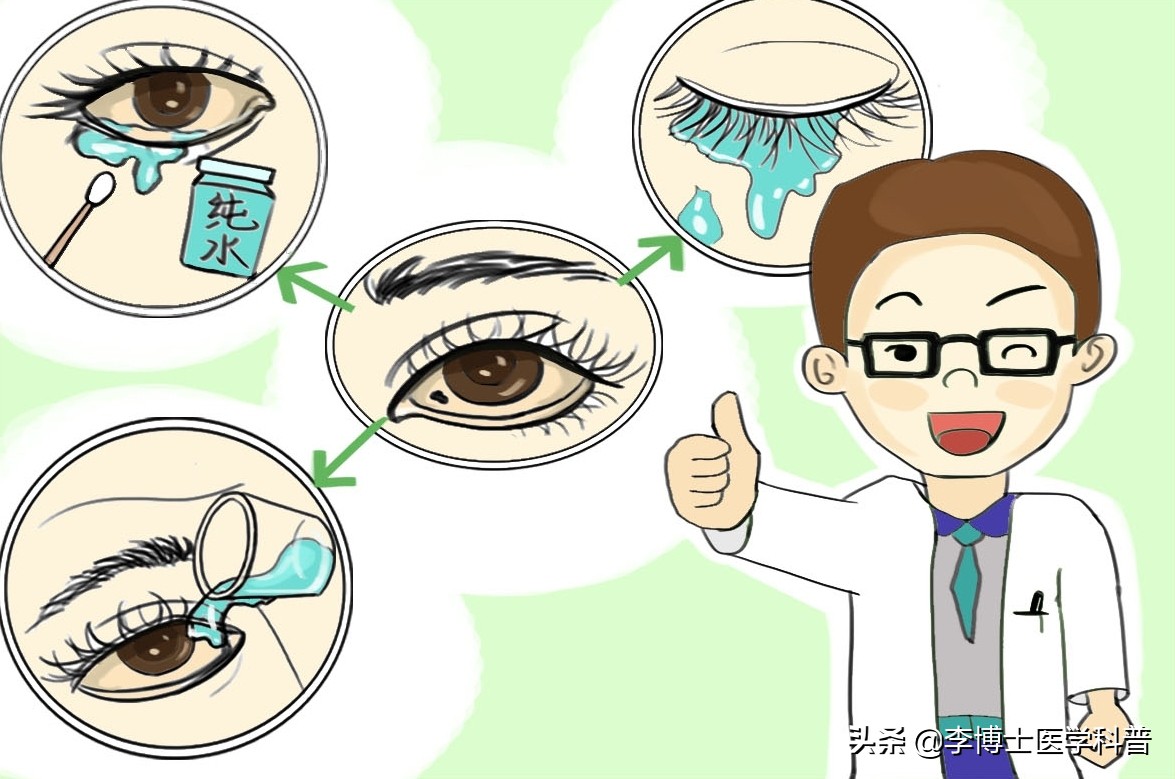 眼球进异物怎么快速去除,眼睛上皮进异物怎么快速去除