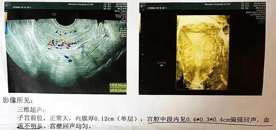 冬病夏治能治好哪些病,冬病夏治有效果没