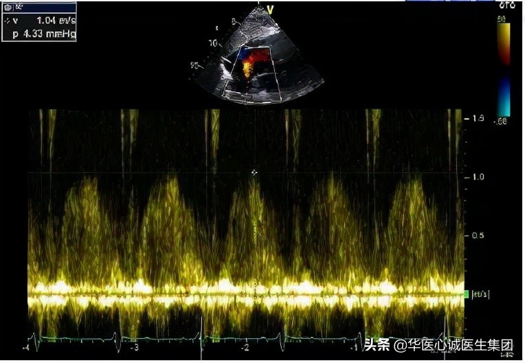 杨颖局部图,杨颖早期下颌宽大
