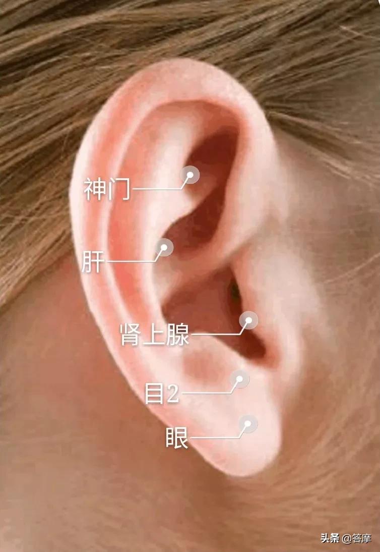 耳穴放血疗法麦粒肿的一大克星,耳穴治疗眼睛的穴位