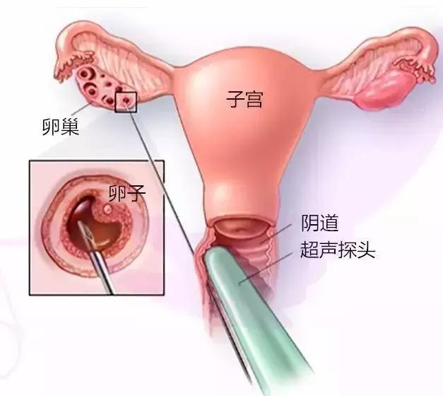 揭露代孕的骗局,揭露代孕黑色产业链的案例