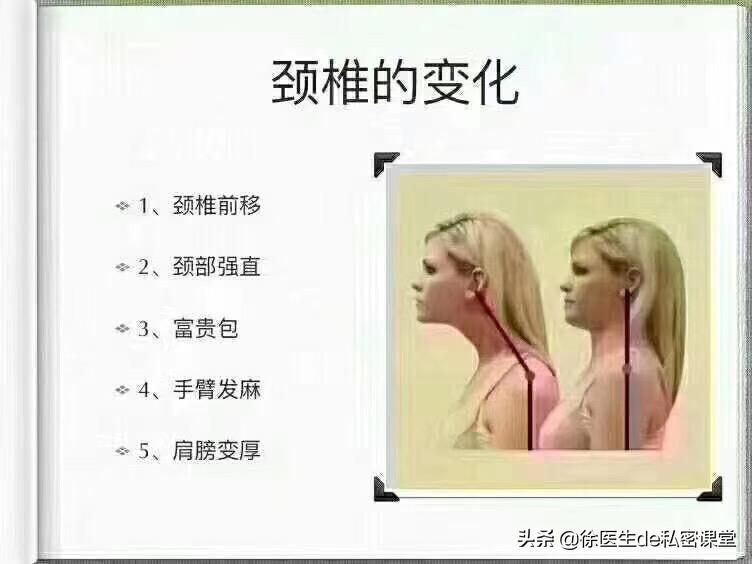 普拉提环产后修复,梵一瑜伽普拉提产后修复私教