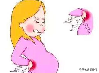 有腰间盘突出史的孕妈妈如何催产,怀孕后导致腰椎间盘突出怎么办