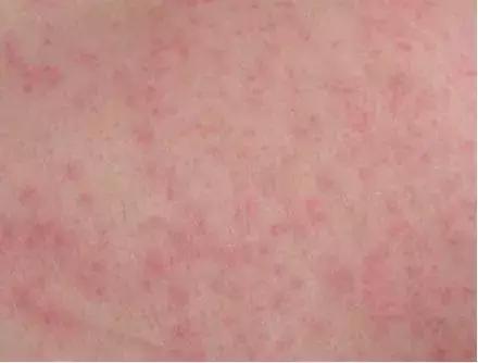 行军拉练,是时候保护好自己的“面子”了