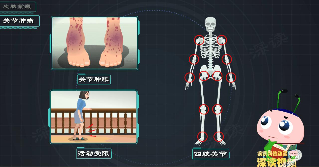 宝宝脚上腿上紫癜早上醒来就减轻,孩子腿上有红疹小心是过敏性紫癜