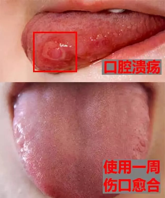 西藏人怎么牙齿白白的,西藏人牙齿白的科学原因