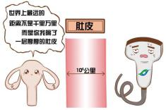 早孕阴式彩超能查出来吗,孕期查看孕囊是做阴超吗