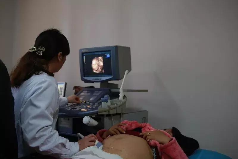 报告上写的是彩超但是是黑白图片,做彩超为什么出来的是黑白图像