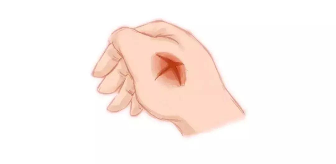 小孩被蚊子叮过怎么尽快消肿,手被蚊子叮了肿了怎么消肿