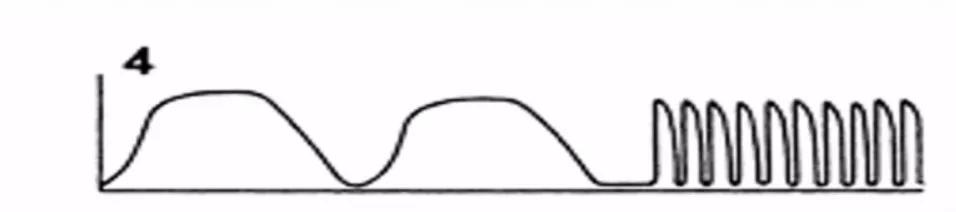 李娟教授：呼气末二氧化碳分压监测的临床应用