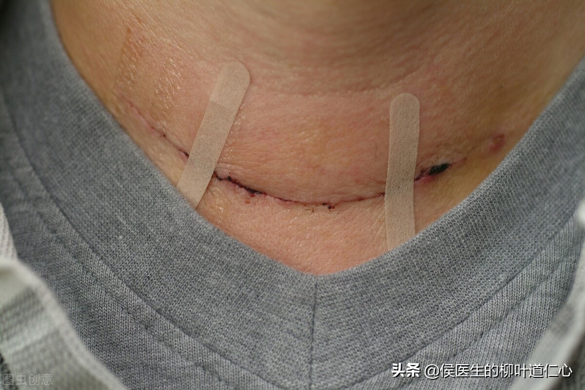 细思极恐的海啸,细思极恐癌症