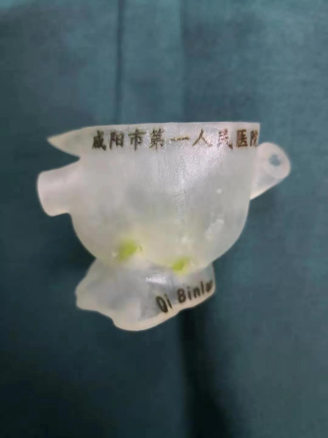 tavr手术华西医院首例,tavr手术国内第一