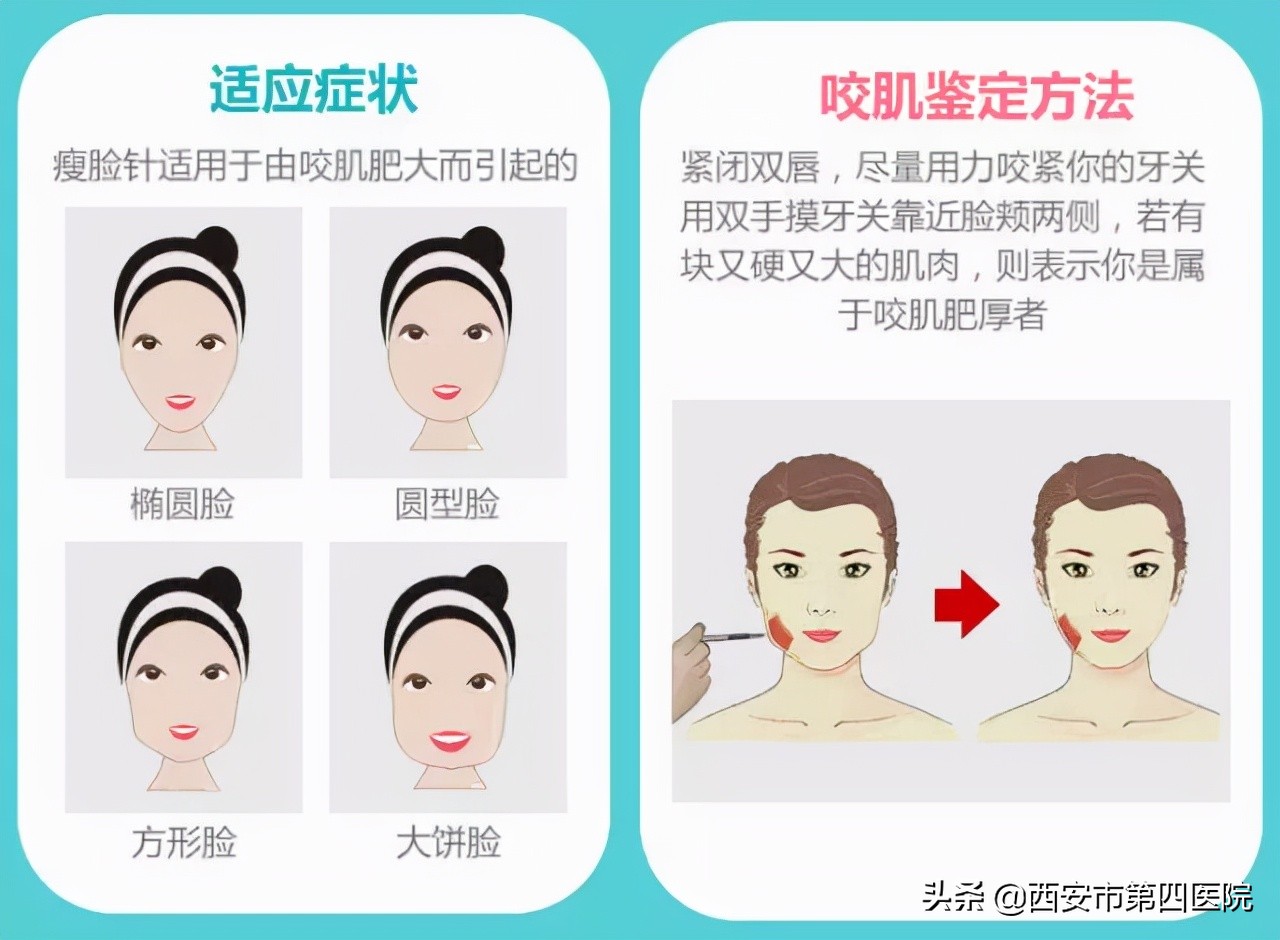 鎵撶槮鑴搁拡鎮勬倓鍙樼編,瀹夊績鍙樼編鐨勪汉閫傚悎鐦﹁劯閽堝悧