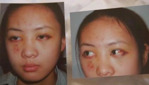 张默家暴事件完整版,张默与童瑶谈了几年恋爱