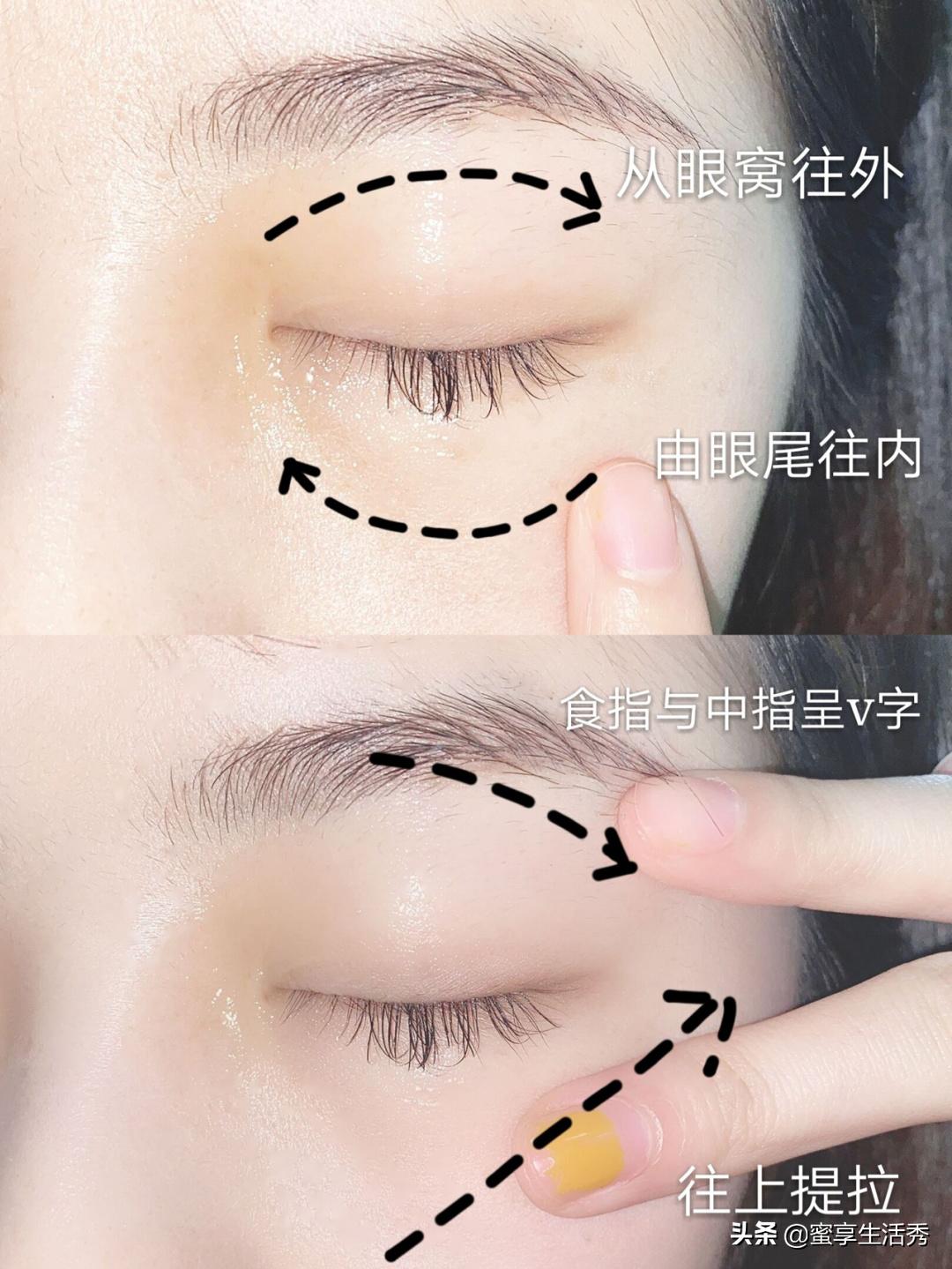 内双眼皮手术变外双效果,内双眼皮怎么变外双按摩最有效