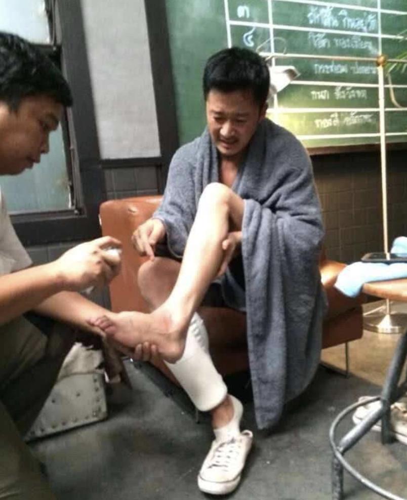 吴京受伤后的表现,吴京受伤记录