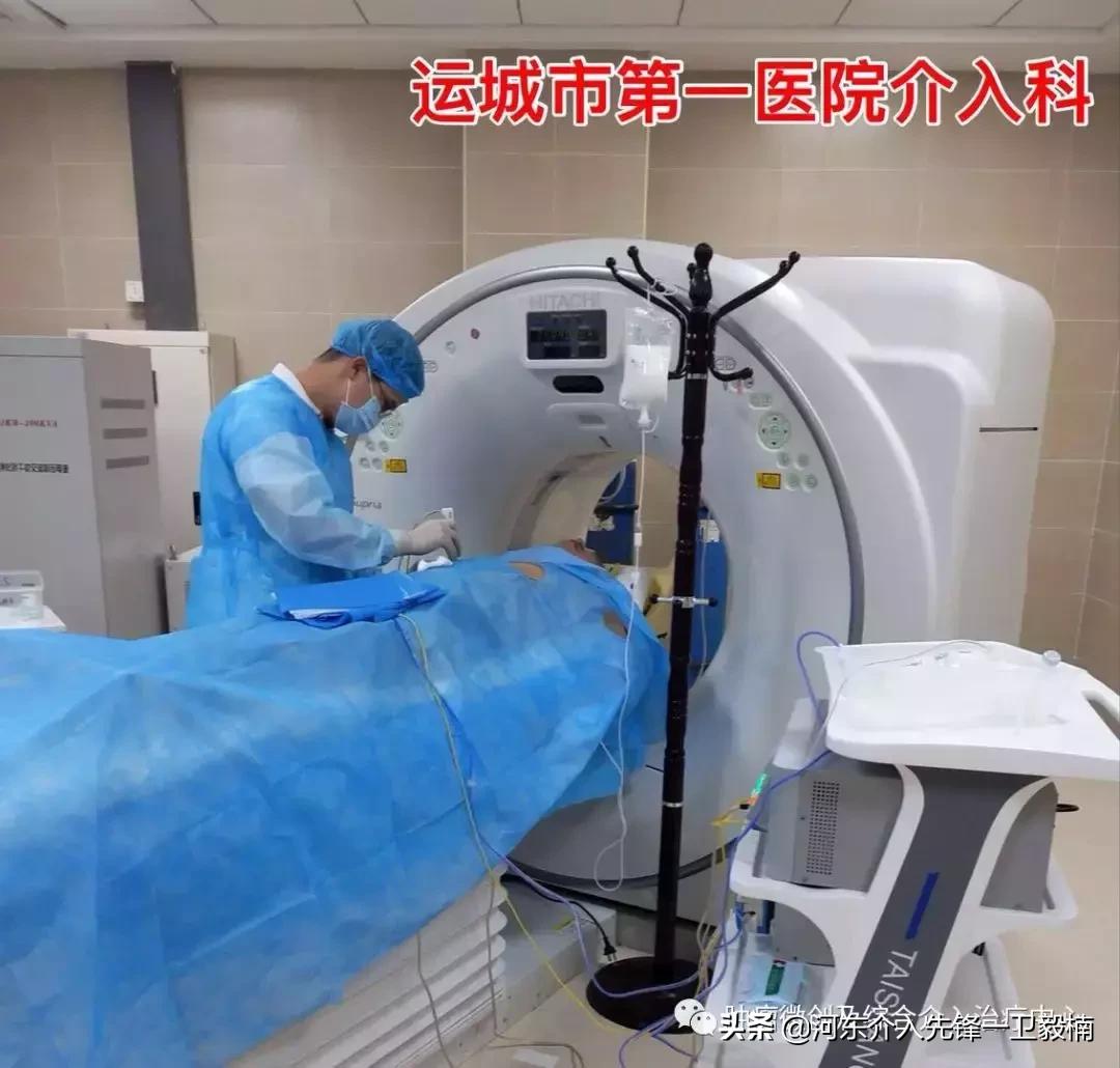 肝癌介入微创消融治疗,肝癌栓塞介入手术