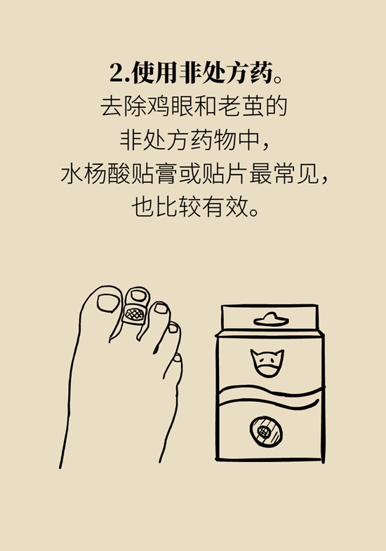 长了鸡眼该怎么办四大妙招教给你,长了鸡眼怎么治疗好得快