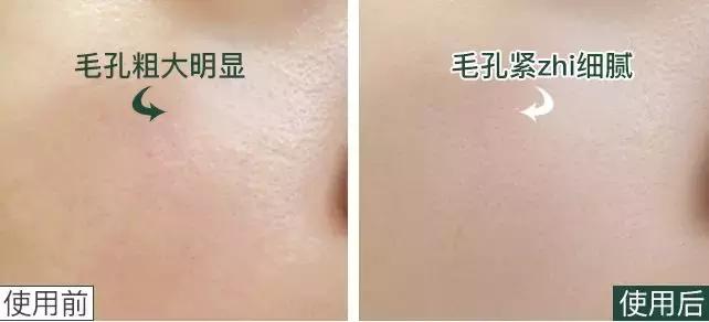 有名的孕妇面膜,网红孕妇面膜