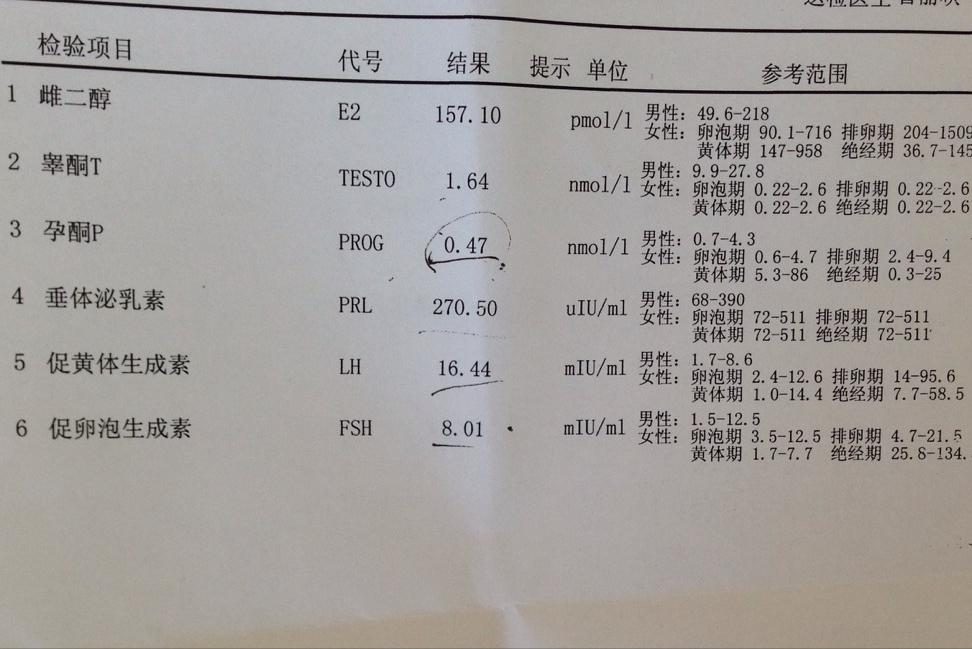 多囊卵巢检查报告,多囊检查12项