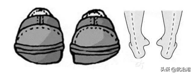 总是磨鞋底怎么办,总是磨鞋底是什么原因