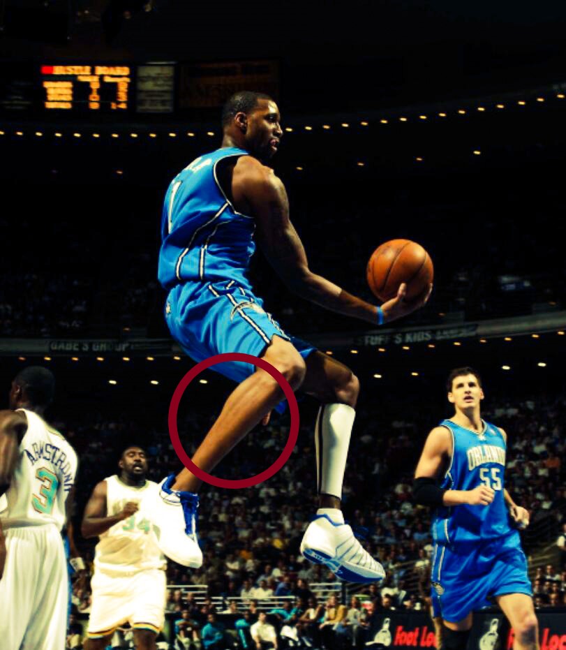 小腿太瘦了怎样可以变粗,小腿粗壮塑形