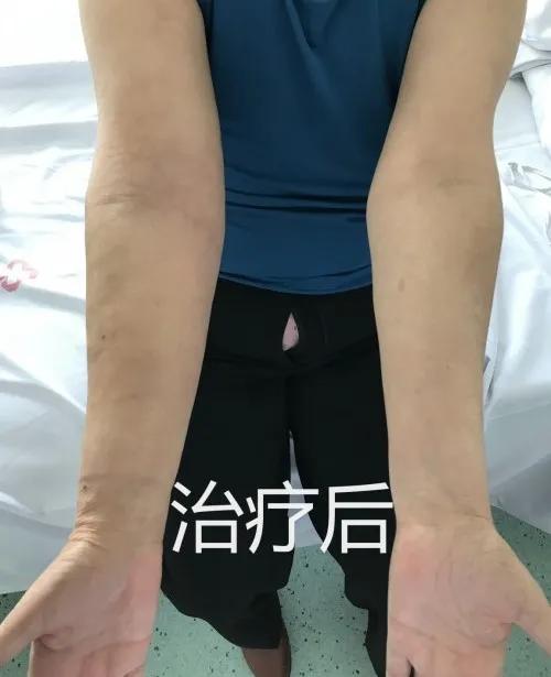 开封市中心医院乳腺甲状腺科,汕头市中心医院甲状腺外科