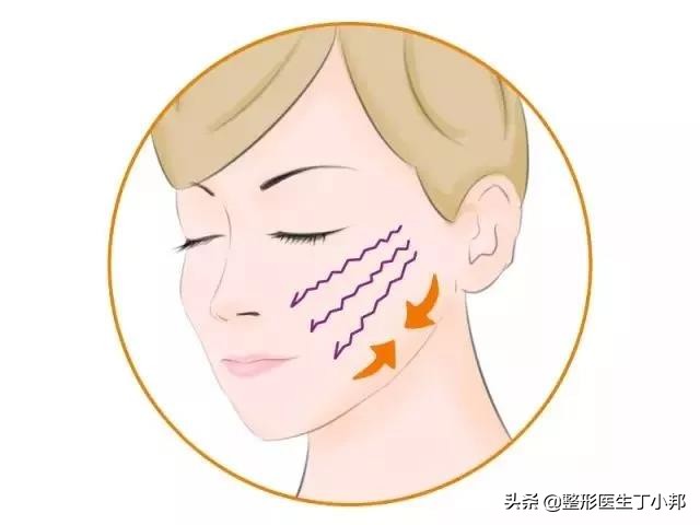 线雕的作用原理视频教学,线雕原理是什么