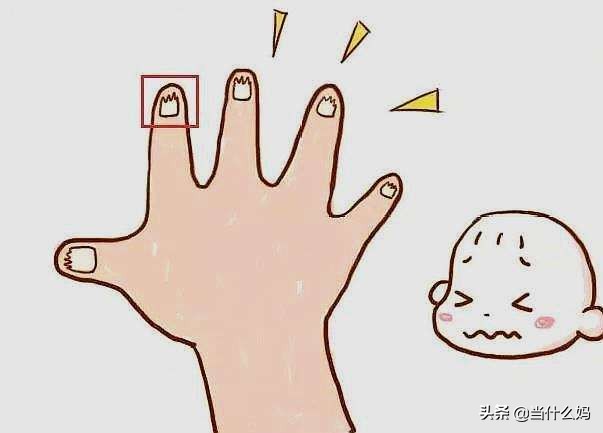 给小宝宝剪指甲剪到手了,你敢把手指甲剪掉吗