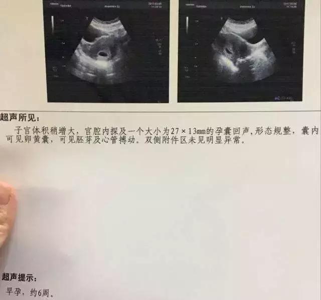 怀孕时间怎么计算呢？教你几招常见的孕周计算方法！