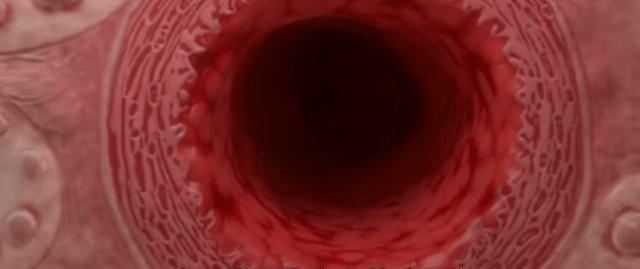 肾脏轻度萎缩的尿毒症治愈的案例,尿毒症脑病一般多长时间能治愈