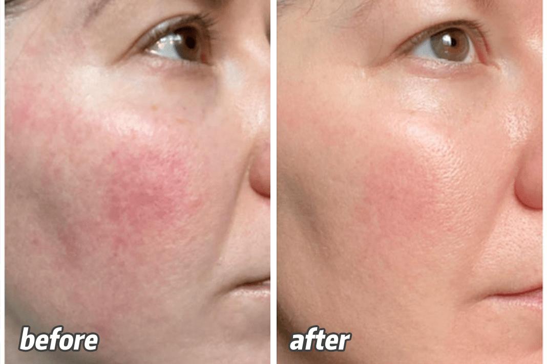 奥运选手都做了美甲,奥运换头选手