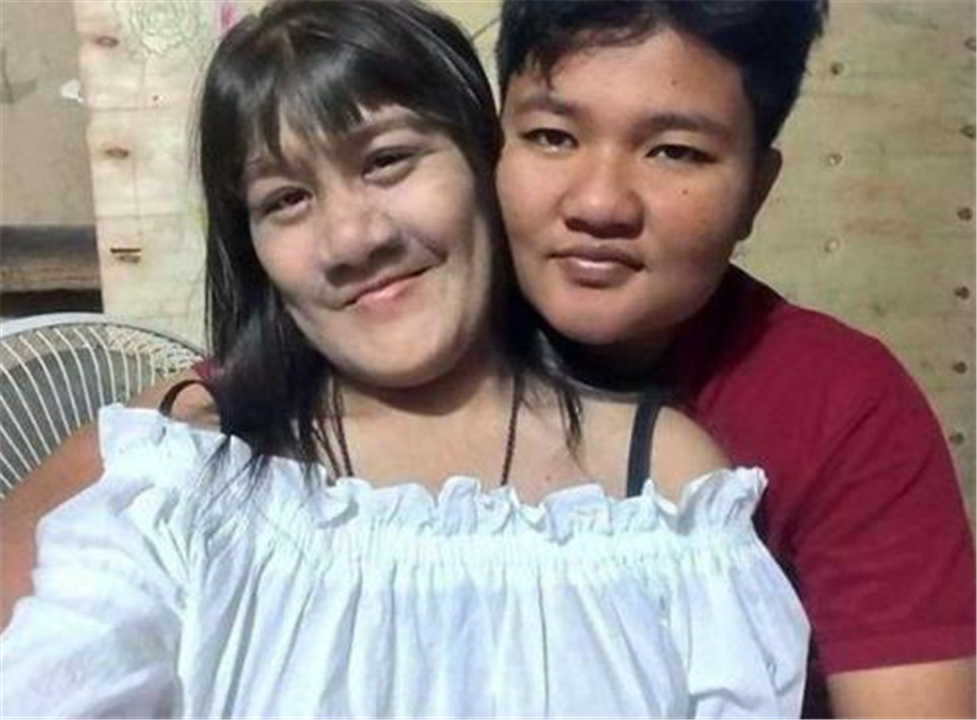 还记得狼人女孩吗？现在为结婚剃去毛发，网友：终于看清脸了