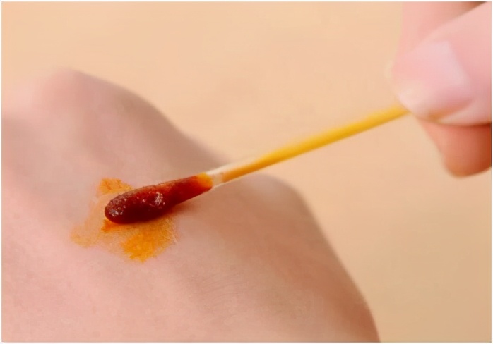 皮肤擦伤有渗出液,皮肤擦伤会留疤吗