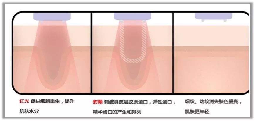 她靠“脸崩”博出位，曾经的女王要“凉凉”