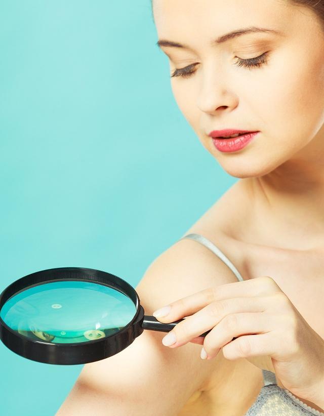 黑色素痣恶化为黑色素瘤的前兆,黑色素瘤会不会危及生命