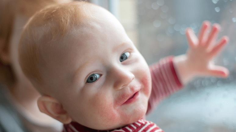 小孩吃芒果过敏去医院,小孩子芒果汁过敏是什么症状