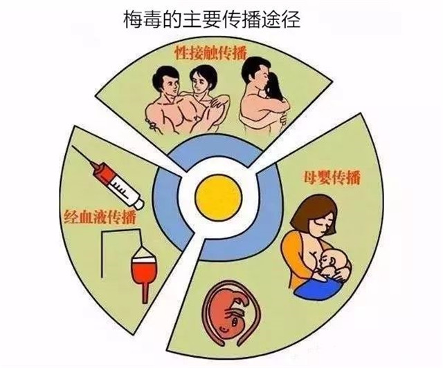 得了梅毒好得快牢记这5点,梅毒致死率多少