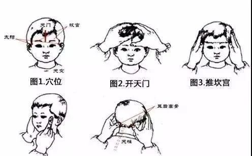 鼻炎流鼻涕推拿哪个穴位最管用,小儿感冒推拿法清鼻涕打喷嚏