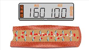 为什么高血压是无形的杀手,高血压是无形杀手吗