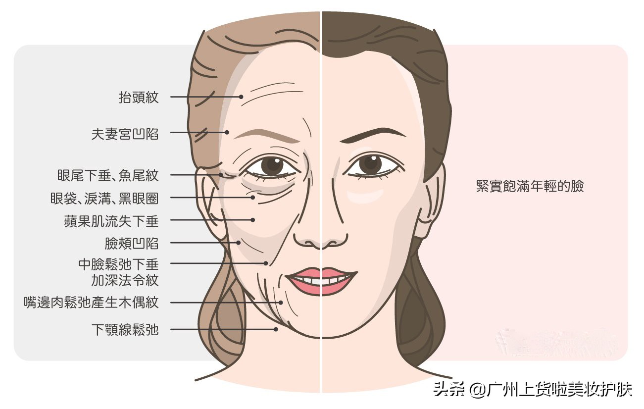 法令纹的种类和改善方法有哪些,法令纹比较深最有效的办法
