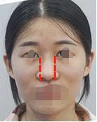 美之峰丁翔最新消息,长沙市美之峰医疗整形