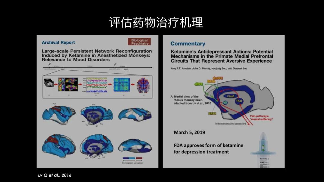 五个能控制你大脑的可怕实验,电击治疗精神分裂症会失忆吗