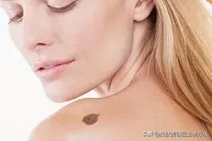 太阳光是uva还是uvb,太阳的紫外线是uvb吗