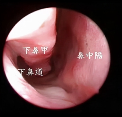 孩子早上起来口臭食欲不振,孩子早晨恶心干呕吃不下饭