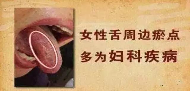 舌头一旦出现这个信号马上找中医,舌头一旦出现这个信号马上去医院