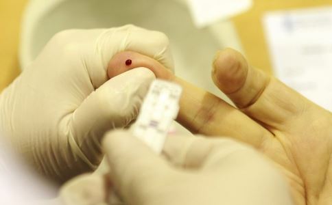 女子骗闺蜜染艾滋识别艾滋病的早期症状