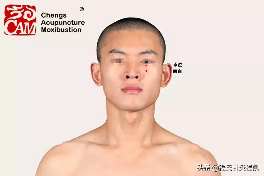 黄斑变性的中医治疗和穴位,中医眼科专家治疗黄斑变性