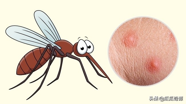 夏季蚊虫叮咬教你一招轻松解决,各种昆虫叮咬清晰图片对照表