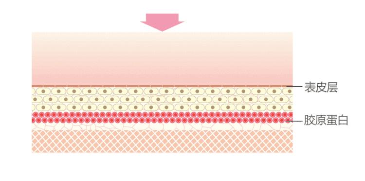 美容射频仪的坑,美容仪的坑你踩过几个